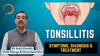 Tonsillitis in children Symptoms diagnosis amp treatment I Dr Ankit Parakh Child Pulmonologist [upl. by Broida]