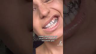 viralshort grillz toothgems fypシ゚viral [upl. by Shirlene]