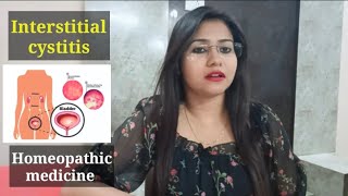 Interstitial cystitis  Homeopathic medicine for interstitial cystitis  Cystitis causes amp symptoms [upl. by Tonina]