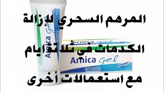 ARNICA GEL الكريم السحري لإزالة الكدمات في ثلاثة أيام  أ رنيكا جيل [upl. by Ramey]