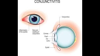 Gland of Eyelid and conjunctiva  Tear film in short [upl. by Sholley]