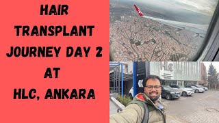 Turkey Hair Transplant  Day 2 VLOG in Ankara  HLC clinic [upl. by Bezanson]