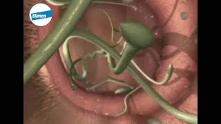 Roundworms life cycle [upl. by Coop]