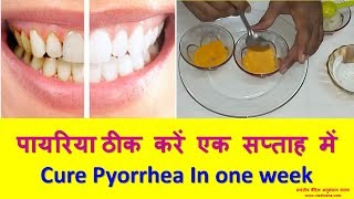 पायरिया ठीक करें एक सप्ताह में  Cure Pyorrhea In one week [upl. by Senecal729]