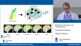 Postoperative Delirium – Please participate in our 3minute survey below [upl. by Godding881]