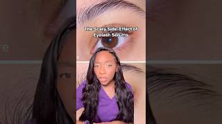 The Dangerous Sideeffects of Eyelash Serums eyelashproducts beautyhacks [upl. by Yatnoj]