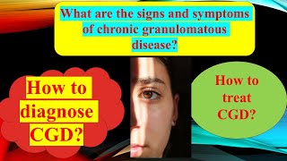 Chronic Granulomatous disease  Autoimmune disease [upl. by Asirac193]