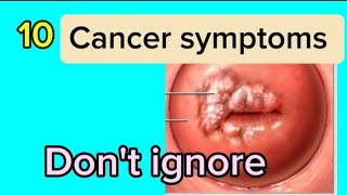 10 symptoms of Cancer Dont ignore [upl. by Enrak]