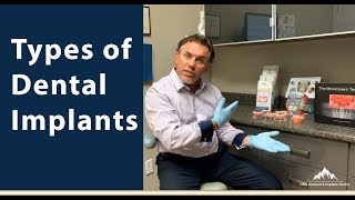 Types of Dental Implants [upl. by Llennahs229]