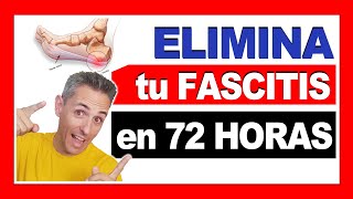 cómo ELIMINAR la Fascitis Plantar en 72 HORAS 🦶 [upl. by Hobbs66]