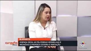 Blefarite infecção das pálpebras  Dra Priscila Naves part Conexão Vitoriosa [upl. by Sevart692]