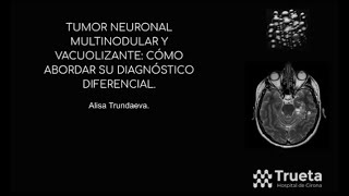 692 Tumor neuronal multinodular y vacuolizante como abordar su diagnóstico diferencial [upl. by Atineb]