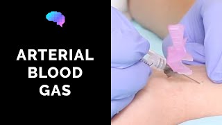 How to take an arterial blood gas ABG  OSCE guide  UKMLA  CPSA [upl. by Quenna]