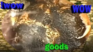 WAR WAX REMOVAL Asmr earwax blockage removalEP204 [upl. by Pardner796]