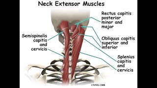 Craniocervical extensor exercise for whiplash injuries [upl. by Cerf]