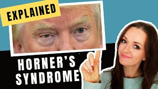 Horners Syndrome Explained Whiteboard Tutorial with Donald Trump [upl. by Eirrotal195]