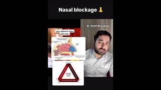 Nasal blockage in babies  noseblock nasalspray parentingtips newparenttips saline newbornbaby [upl. by Enaek]