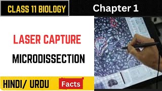 What is laser capture microdissection Laser capture microdissection Laser microdissection by bilal [upl. by Carrillo520]