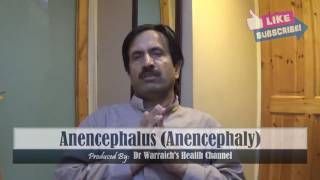 Anencephalus  Anencephaly  Causes Symptoms Diagnosis Treatment Complications [upl. by Nnaacissej928]