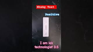 HBSAG test medicallabtechnologist likeandsubscribe [upl. by Akili944]