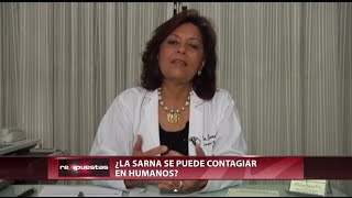 ¿La sarna se puede contagiar en humanos [upl. by Gavra]