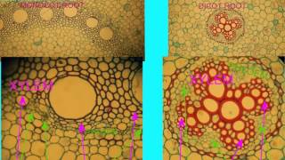 What is the difference between Monocot and Dicot plants  Biology  Extraclasscom [upl. by Sofer]