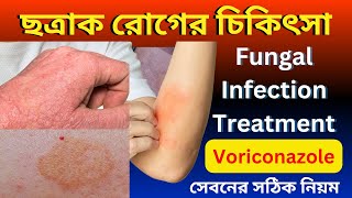 Fungal infection Treatment Bangla  Voriconazole Votab 200 সেবনের সঠিক নিয়ম [upl. by Anipsed]