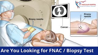 Biopsy FNAC Test in Hyderabad  Liver Lymph Node Thyroid Kidney Bone FNAC Biopsy  Official [upl. by Vitalis]