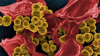 المكورات العنقودية الذهبية المقاومة للميثيسيلين ‏Methicillinresistant Staphylococcus aureus MRSA [upl. by Magnus328]