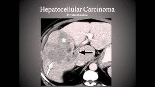 The Hepatobiliary System [upl. by Jordanna]