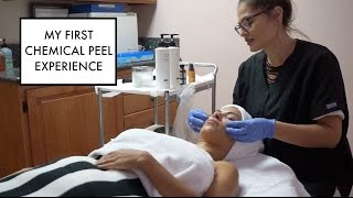 MY FIRST CHEMICAL PEEL EXPERIENCE vlog  PCA Skin Products [upl. by Olnay]