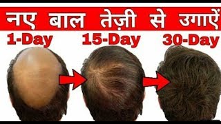 Hair loss and hair treatment  Minokem N 5 lotion review  My Healthy Tips [upl. by Tawney]