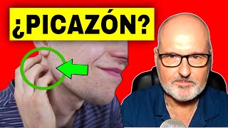 PICOR COMEZÓN 💥 CAUSAS COMPLICACIONES y ALIVIO [upl. by Drugge]