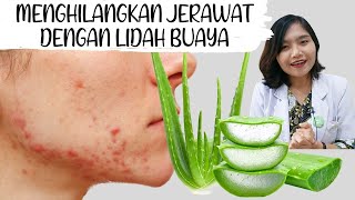 DIY Aloe Vera untuk Jerawat  Cara Pakai Lidah Buaya dirumah  dr Emasuperr [upl. by Casper252]