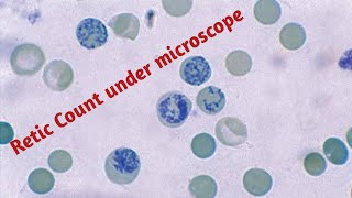 Reticulocyte  Reticulocyte count test in hindi [upl. by Satterlee]