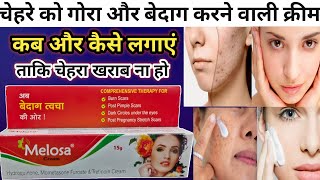 Melosa Cream Review in Hindi  चेहरे को गोरा बनाने वाली क्रीम  Melosa Cream  Face whitening cream [upl. by Crispas]