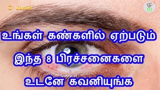 உங்கள் கண்களில் ஏற்படும் இந்த 8 பிரச்சனைகளை உடனே கவனியுங்க [upl. by Erlandson]