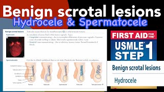 Benign scrotal lesions Hydrocele amp Spermatocele in HindiUrdu by first aid for USMLE step 1 [upl. by Sanfo]