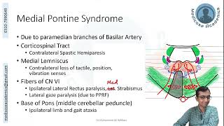 Lesions of Pons [upl. by Alemaj]