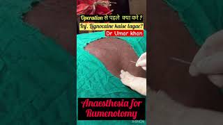 Rumenotomy l Bloat l Tympani l dr Umar khan [upl. by Aleras]