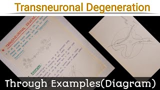 Transneuronal Degeneration [upl. by Stephie]