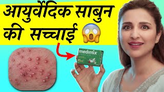 Medimix Soap Review फायदे नुक़सान और उपयोग विधि  मेडिमिक्स साबुन की जानकारी [upl. by Kean]