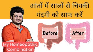 आंतों में सालों से चिपकी गंदगी को साफ करें  My Homeopathic Combination  How to use [upl. by Flannery691]