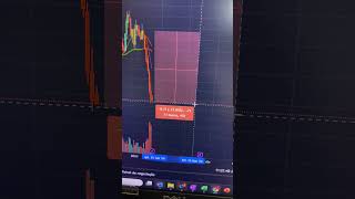 QUAL3  Qualicorp DERRETENDO novamente  qualicorp qual3 investimentos mercadofinanceiro [upl. by Peirce]