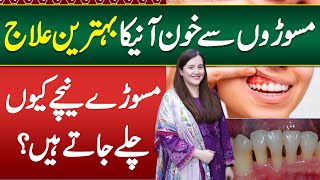 Gums Bleeding Treatment  Masoro Ki Sujan Ka ilaj  Masudo Ki Swelling Ka ilaj Gums Swelling Remedy [upl. by Nannaihr429]