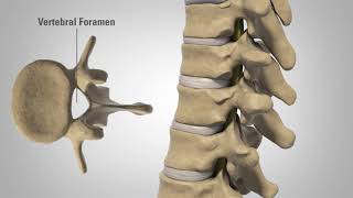 Myelopathy  Patient Education [upl. by Abramo]