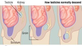 Descend of the Testes Normal Part 02  2nd Year MBBS OSPE [upl. by Yggep]