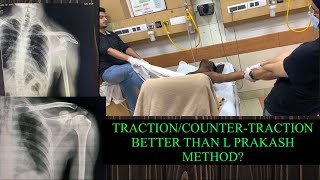 TractionCountertraction better than the L Prakash External rotation method [upl. by Argela]