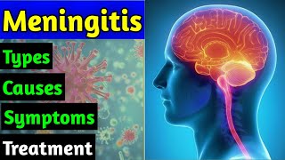 Meningitis differential Diagnose  How to treat Meningitis [upl. by Nylave877]