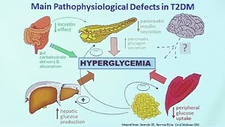 Making Sense of Diabetic Medications [upl. by Einnad]